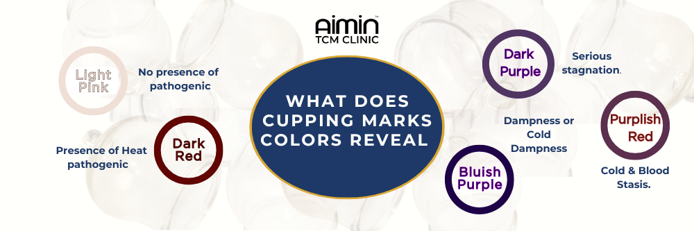 TCM Cupping Marks: What the Colors Reveal About Your Health