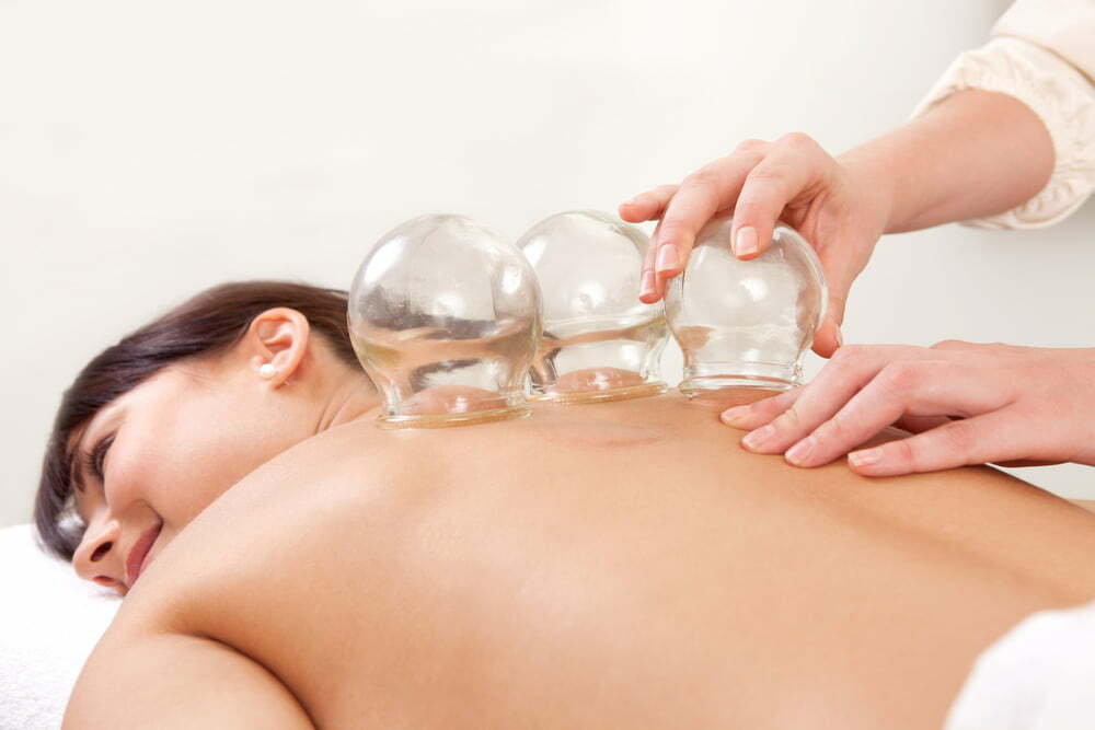 Cupping Treatment