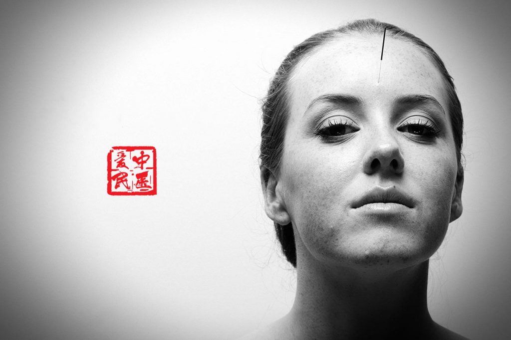 facial acupuncture - enhance facial Skin health , reduce fats and water retention