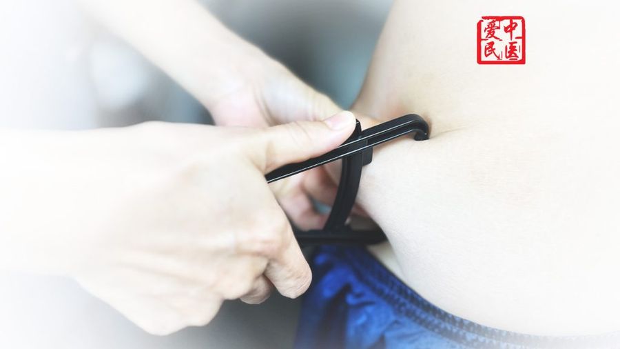 Fat-freeze-b4-procedure-measuring-fats
