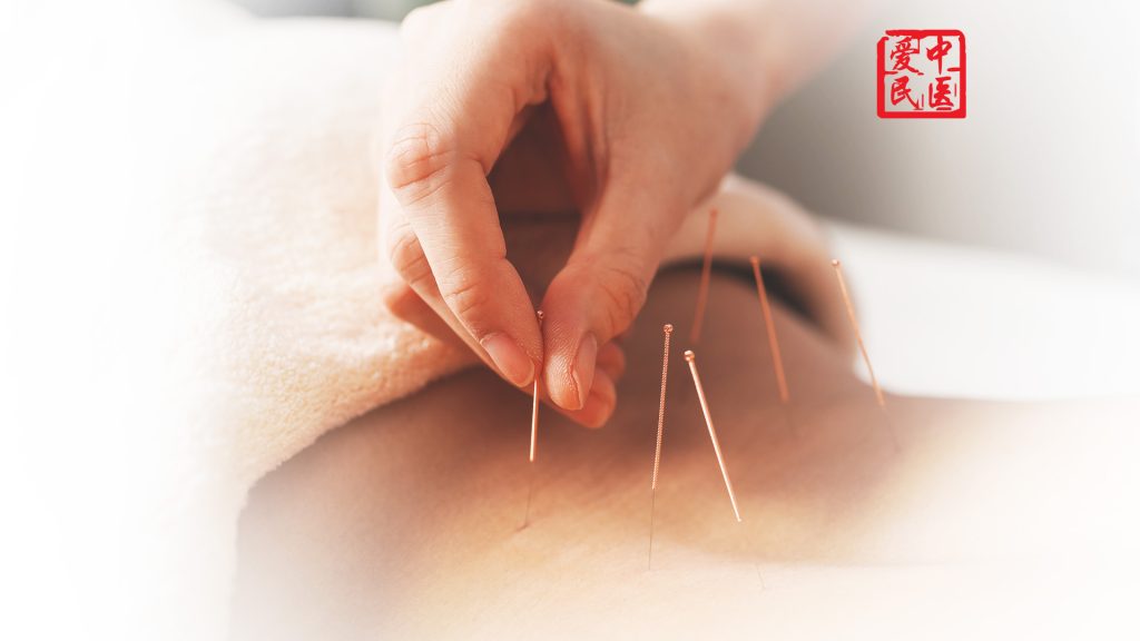 Pain-Management tcm Acupuncture