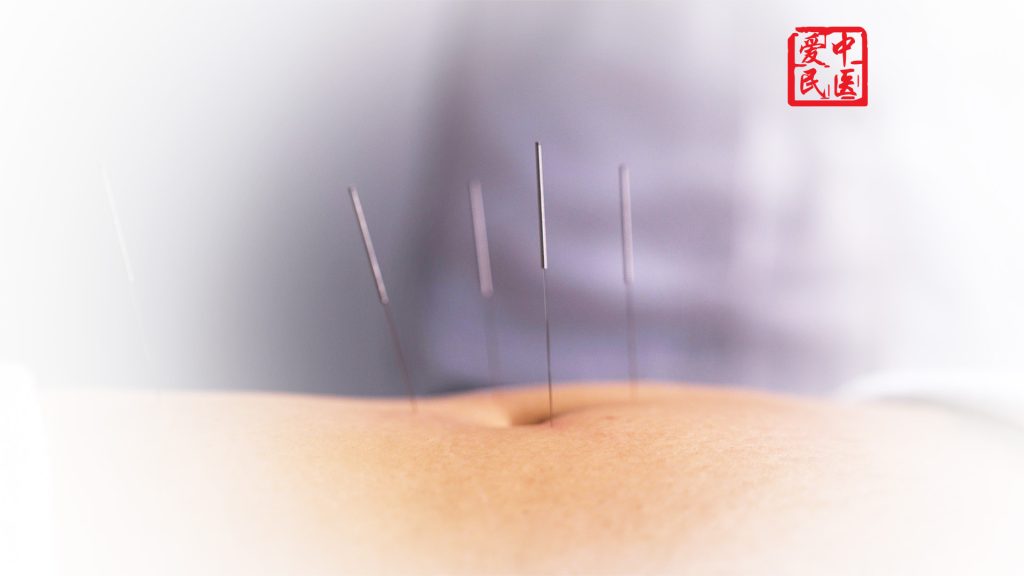 tcm Treatment-Acupuncture