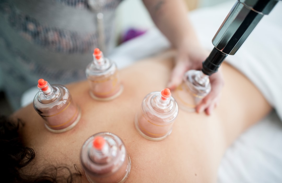 Cupping therapy treatment at Aimin TCM Clinic
