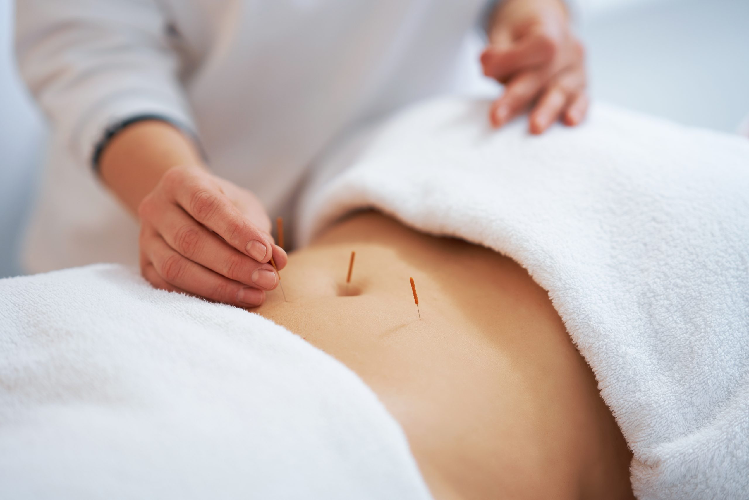 Can Acupuncture Work for Weight Loss?